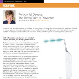 Periodontal Disease: The Three Pillars of Prevention